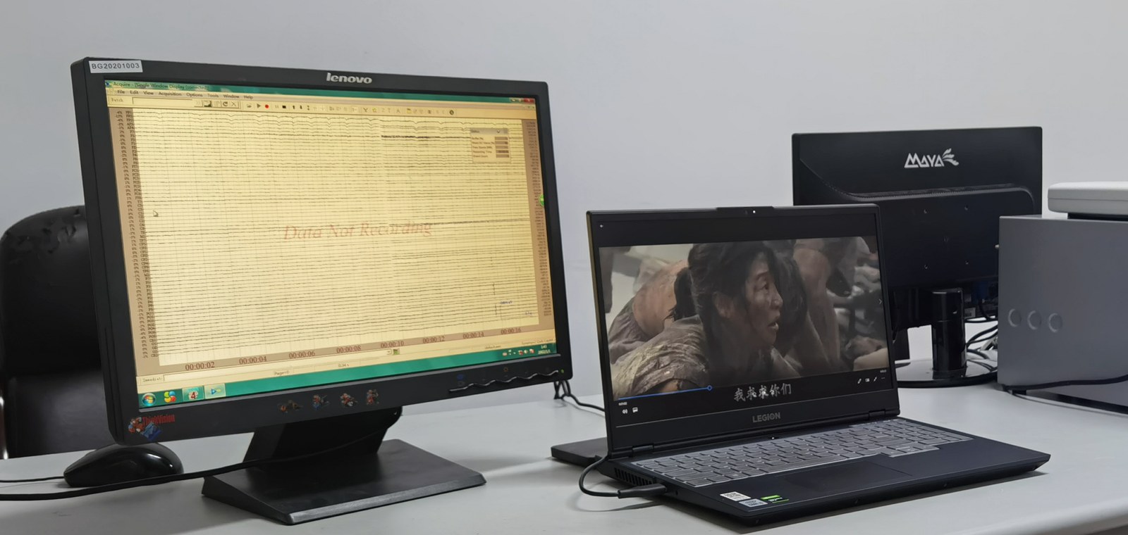 HIED EEG experiment setup with acquisition equipment and stimulus display